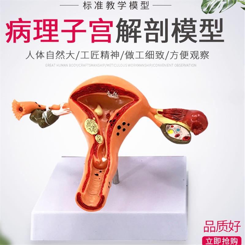 女性大子宫模型放大模型 女性生殖解剖模型 计划生育示教模型