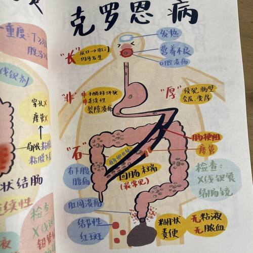 自制手绘医学生笔记创意人体漫画趣味图解笔记彩色双面胶装A5宝典