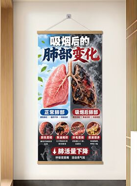 医院禁烟肺部变化警示画