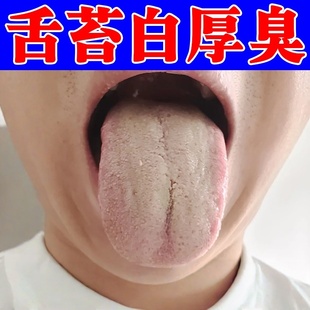 舌苔白厚舌头中间裂痕裂纹舌头边缘有齿痕去舌焱舌头灼痛口苦口臭