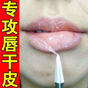嘴巴干裂唇膏专用修护嘴唇脱皮润唇膏嘴皮开裂嘴巴干燥起皮开裂口