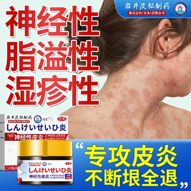 皮炎神经性溢脂性面部搭去止痒根外用膏除顽固药特效皮肤瘙痒湿