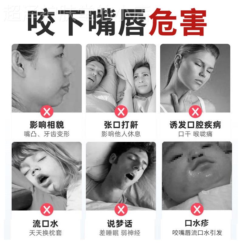 宝宝防咬下嘴唇纠正器改善小孩子口呼吸神器戒咬嘴唇矫正前庭盾贴