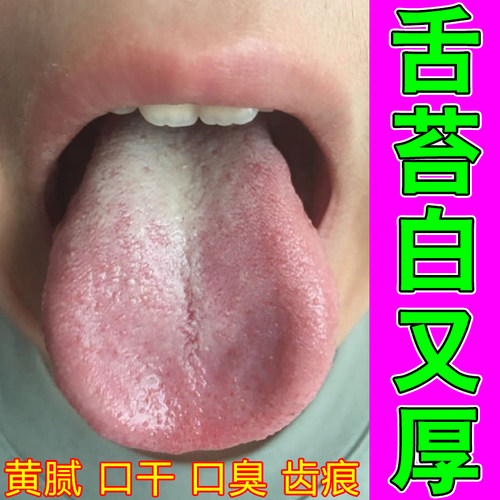 舌苔白厚有裂纹舌面干裂粗糙说话涩痛草本药剂柔改善减轻舌体紧绷