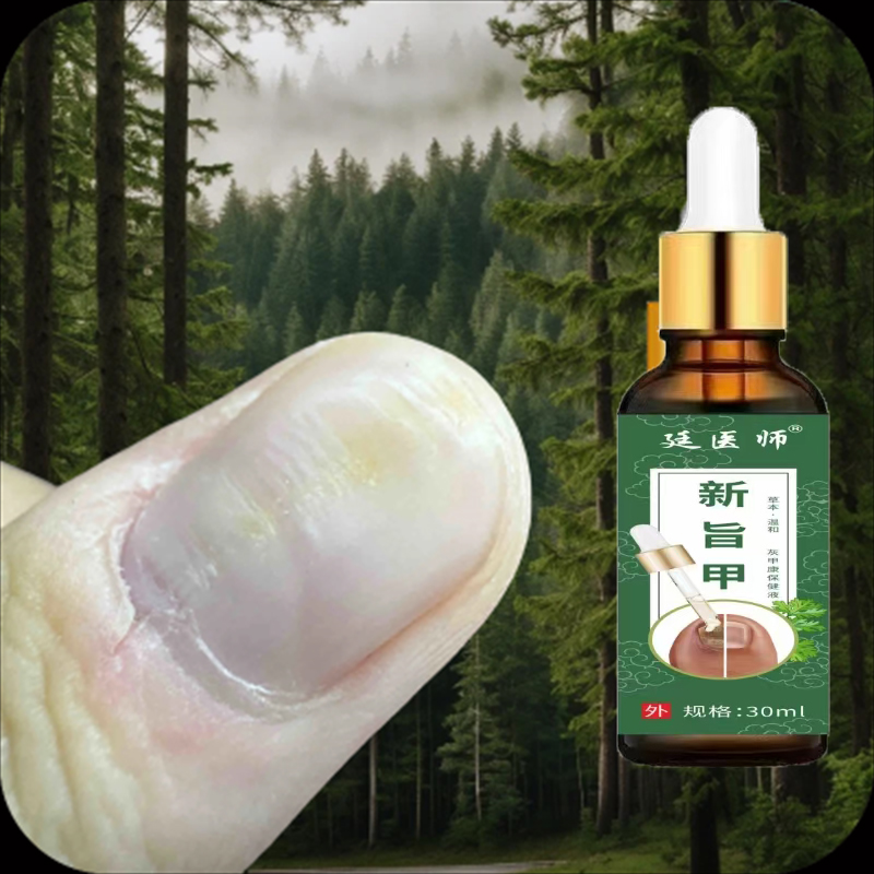 指甲表面横纹凹陷粗糙指甲裂缝淤血指甲甲母痣断甲空心甲生长指甲