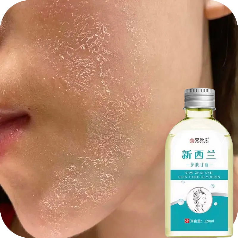 脸上干燥起皮掉皮脸干痒面部干痒泛红刺痛脸太干脱皮皮肤粗糙卡粉