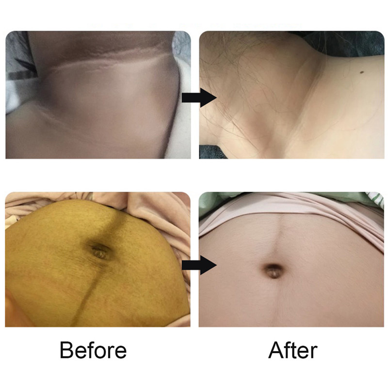 Women Private Intimate 100G Bamboo Charcoal Vagina Whitening