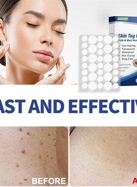 144pcs/box Invisible Wart Removal Patches Mole Warts Removal