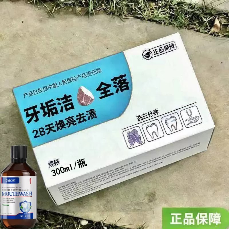 【重度牙结石】牙石溶解漱口水洗牙齿污垢牙垢牙黄牙渍清理