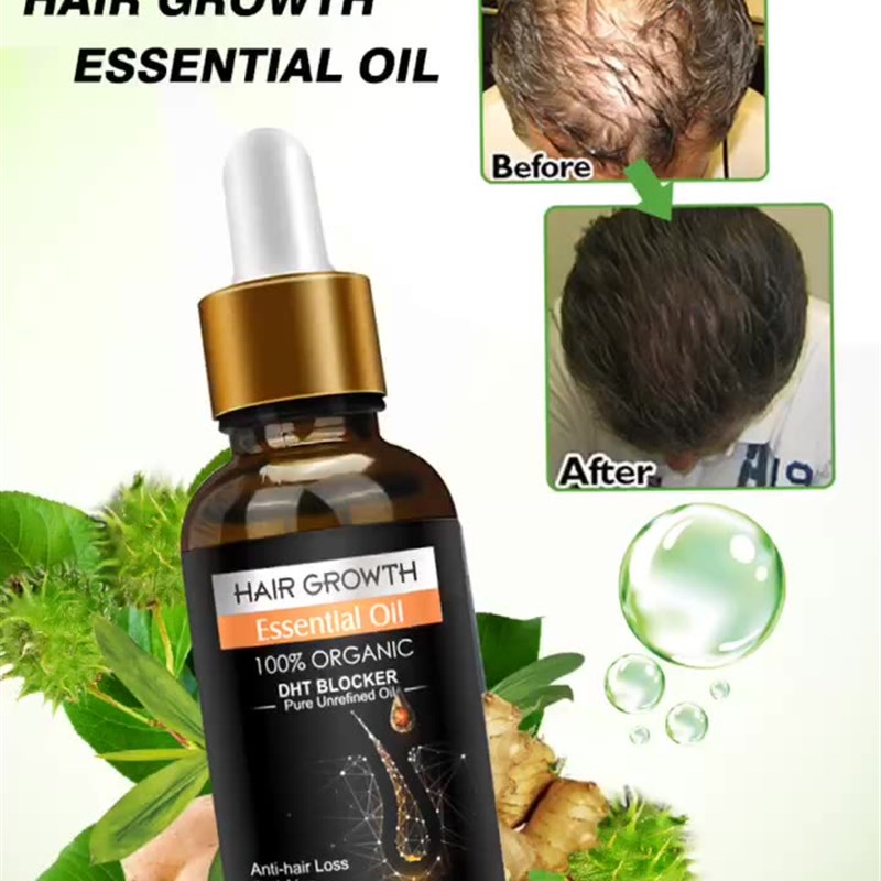 Hairgrowth kit Scalp Care hair essential oil头发护理精油套装