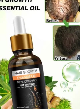 Hairgrowth kit Scalp Care hair essential oil头发护理精油套装