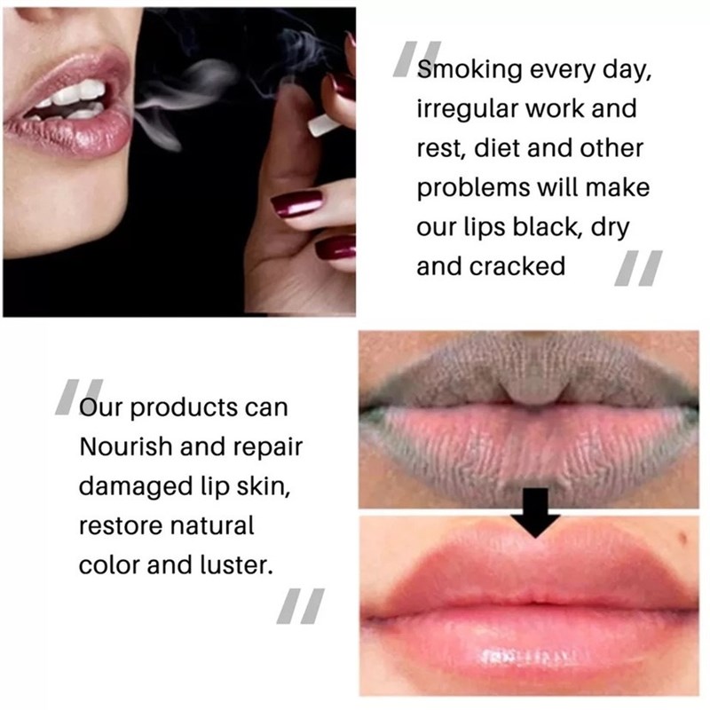 Lip Black Removal Lip Balm Exfoliating Fade Black Lip Care