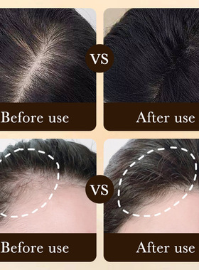 好货Fast Hair Growth Essence Effective Anti Hair Loss Serum