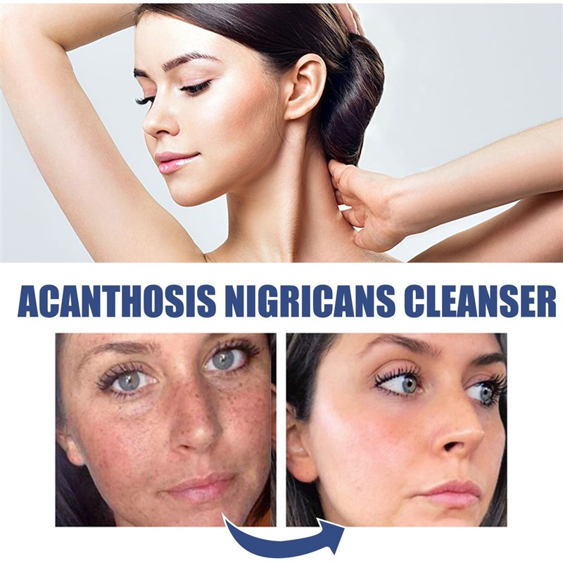 Skin Cleanser Deep Cleansing, Moisturizing, Repairing, And