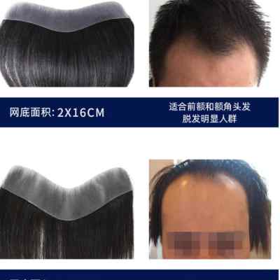 好货发际线假发贴男士前额发际线假浏海真发隐形生物头皮V型额头