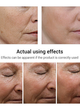 Stant nstant Remoove rinrinkle rinream ine ine ines ine ines