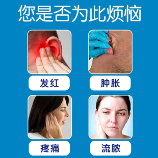 耳洞疙瘩增生耳洞发炎护理液耳朵痒耳洞流脓过敏消炎专用清洁神器