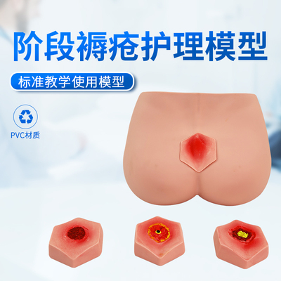 蓝蝶模型老年人阶段褥疮护理教具