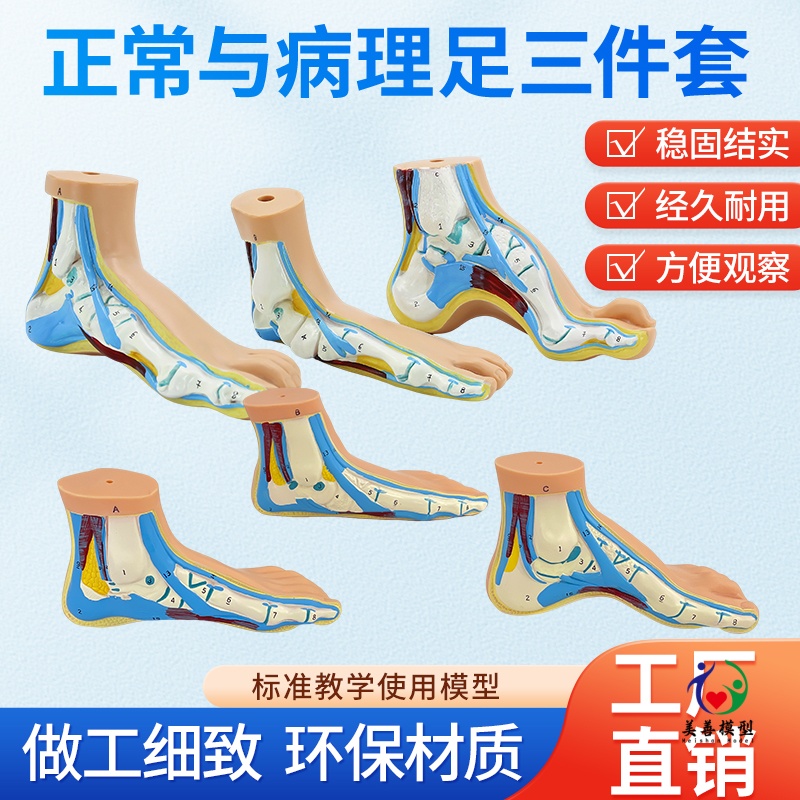 蓝蝶模型足部病理肌肉解剖