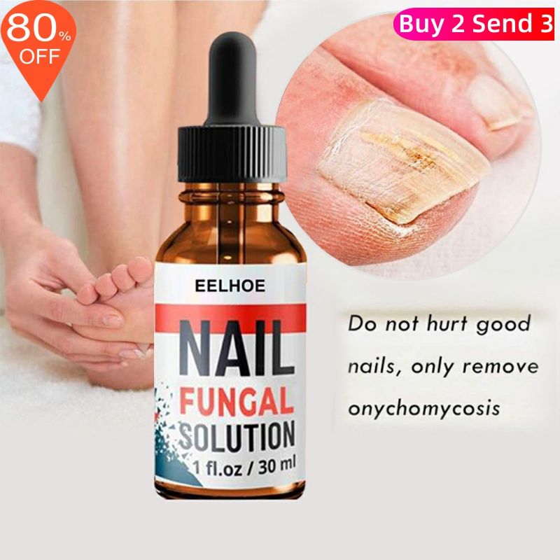 Foot Finger Liquid Anti Fungal Repair Serum Nail Removal Gel