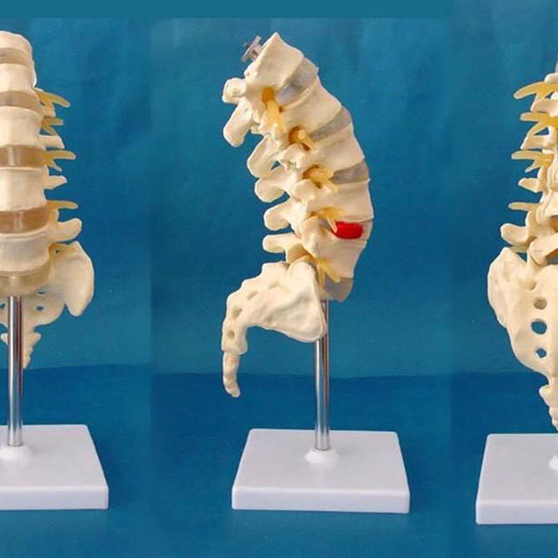 人1:1可拆5节腰椎尾骨模型脊体椎椎间盘突出 人体教学骶骨