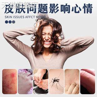 旗舰店官方正品正泰林止痒膏皮肤软膏乳膏全身抑菌护理膏真菌王