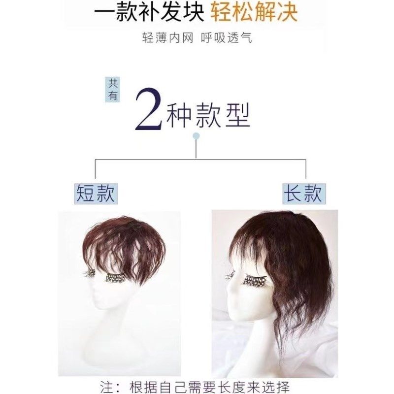 女洋气女新新款女士新款刘海真头皮假发片补发片头顶补发块