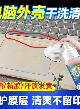 笔记本电脑外壳清洁油污汗渍发黄