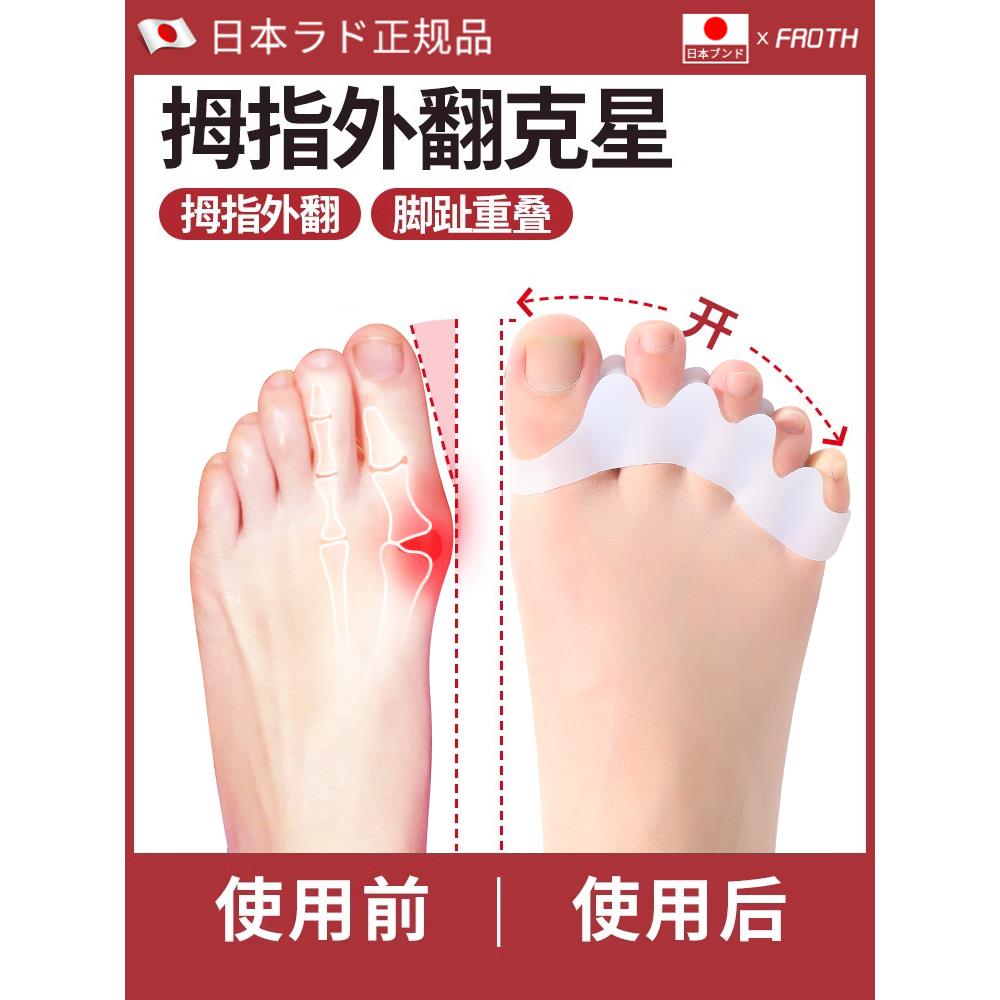 日本脚趾矫正器脚趾分离器拇指外翻脚趾分离器男女五指套脚趾分离