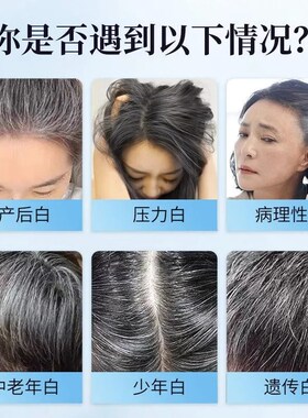 北京同仁c堂铁叶酸片博客健牌补铁男女备孕养发官方店官网正品