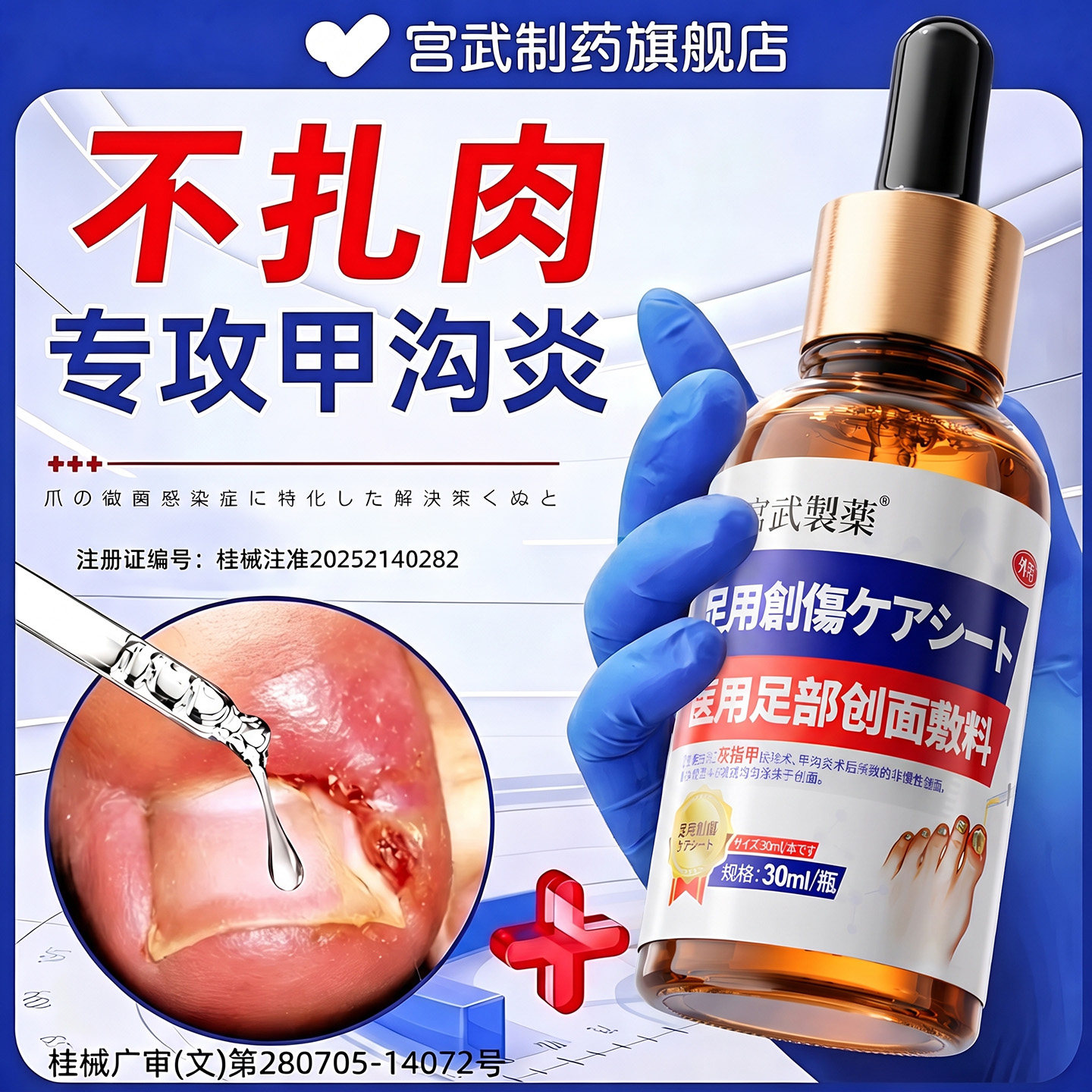 医用甲沟炎专治嵌甲息肉祛除软化剂脚趾甲往肉里长消红肿化脓神器