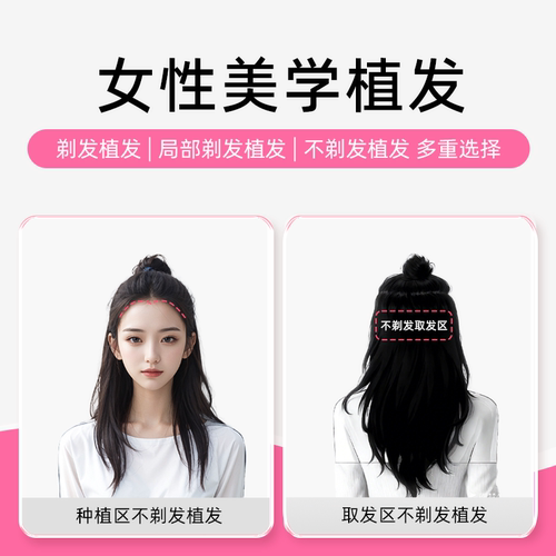 雍禾植发【预约金】 西宁专属