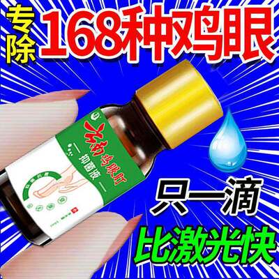 鸡眼药水鸡尤康鸡茧眼膏老茧眼贴脚趾净脚底平灵脚上手足部抑菌液