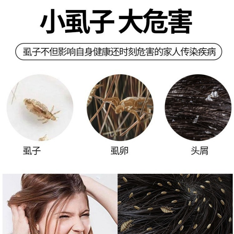 篦子梳去头屑虱卵虱子梳超密齿老
