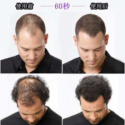 密丰增发纤维假发密发粉补充包袋装快速补发男女美发浓头发稀疏多