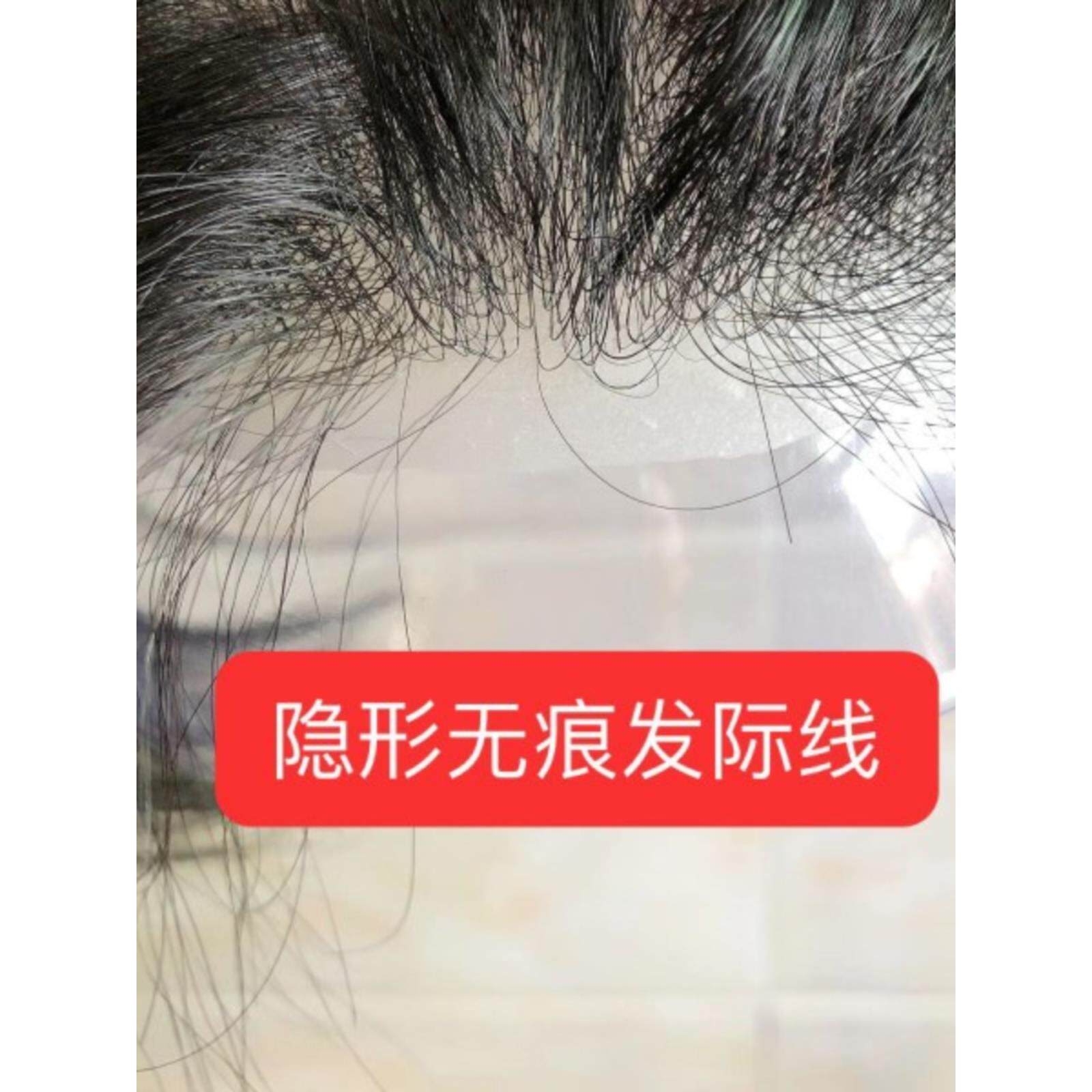 前额发际线假发贴隐形真人发M型头顶补发块生物头皮假刘海补发片