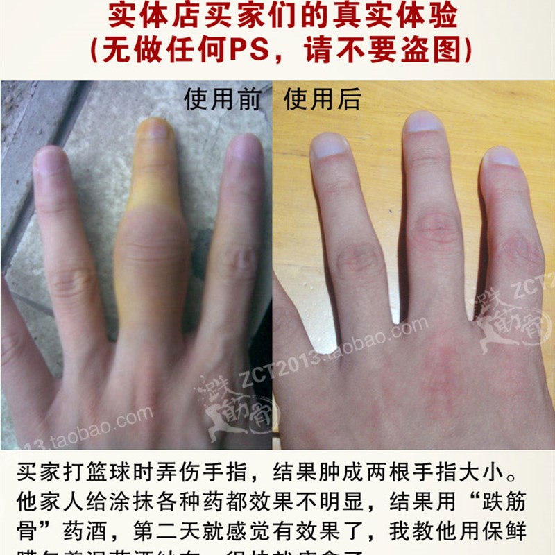 跌打酒手腕扭伤肌肉拉伤骨折骨裂软组织损伤腰骨疼痛腰酸背痛药酒