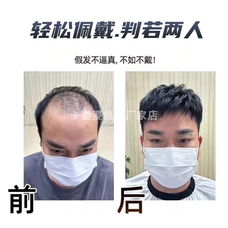 假发男npu边全递针真发隐形补发片蓬松自然头顶遮Z秃顶短直发
