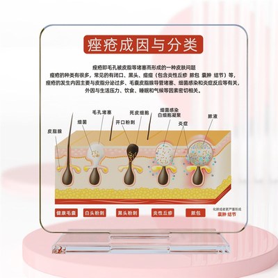 医美知识展示牌四大问题肌肤成因亚克力桌牌高颜值桌Z牌斑敏痘衰