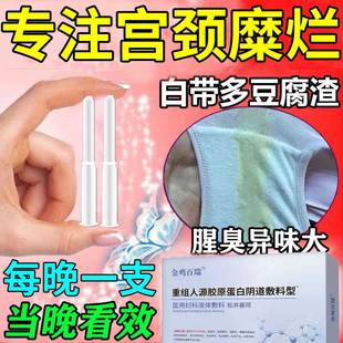 宫颈糜烂霉菌性阴道炎外阴瘙痒白带豆腐渣阴道专塞药妇科炎症用ZT