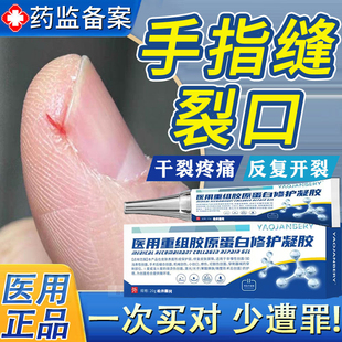 指甲边缘裂口手指头裂口子脱皮开裂干裂真菌感染愈合膏防皲裂口LL