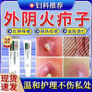 外阴疖肿拔毒膏长痘火疖子脓包硬块长硬疙瘩私处拔脓肿痛医用正LY