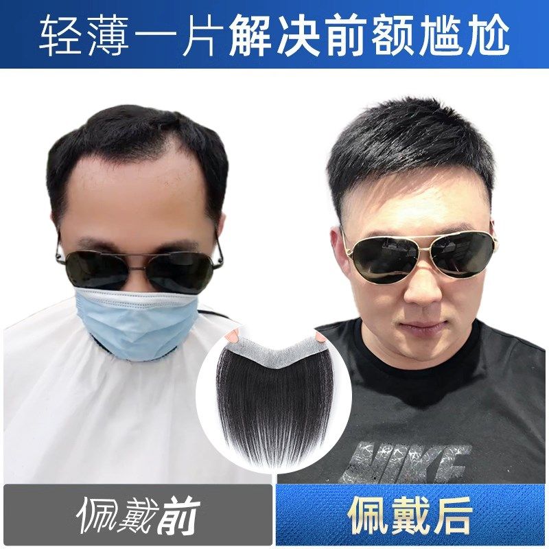 发际线贴男假发片男士全真人发丝前额假刘海m型背头真发补发片男