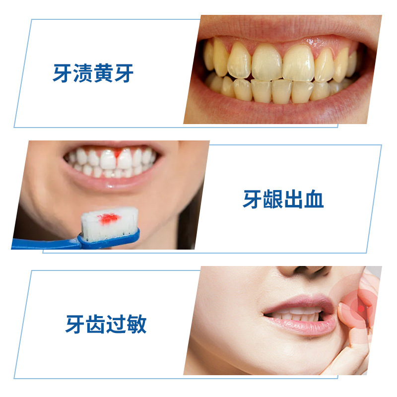 南同医用口腔护理膏防蛀固齿预防蛀牙牙龈肿痛清新口气牙膏