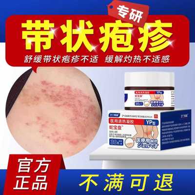 芝兰悦康蛇宝盘苗区直播推荐