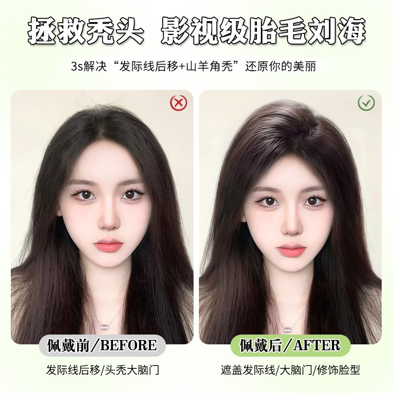 胎毛刘海头顶真发轻薄自然假发贴无痕发际线前额鬓角补发假发女片