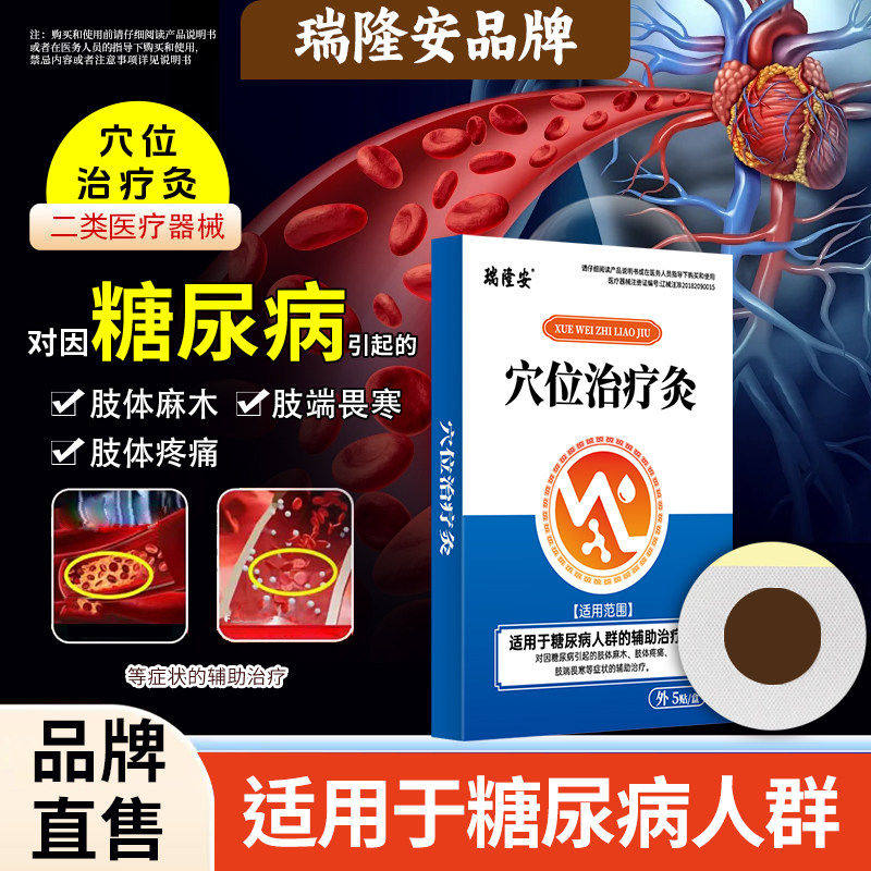 瑞隆安穴位治疗灸对因糖尿
