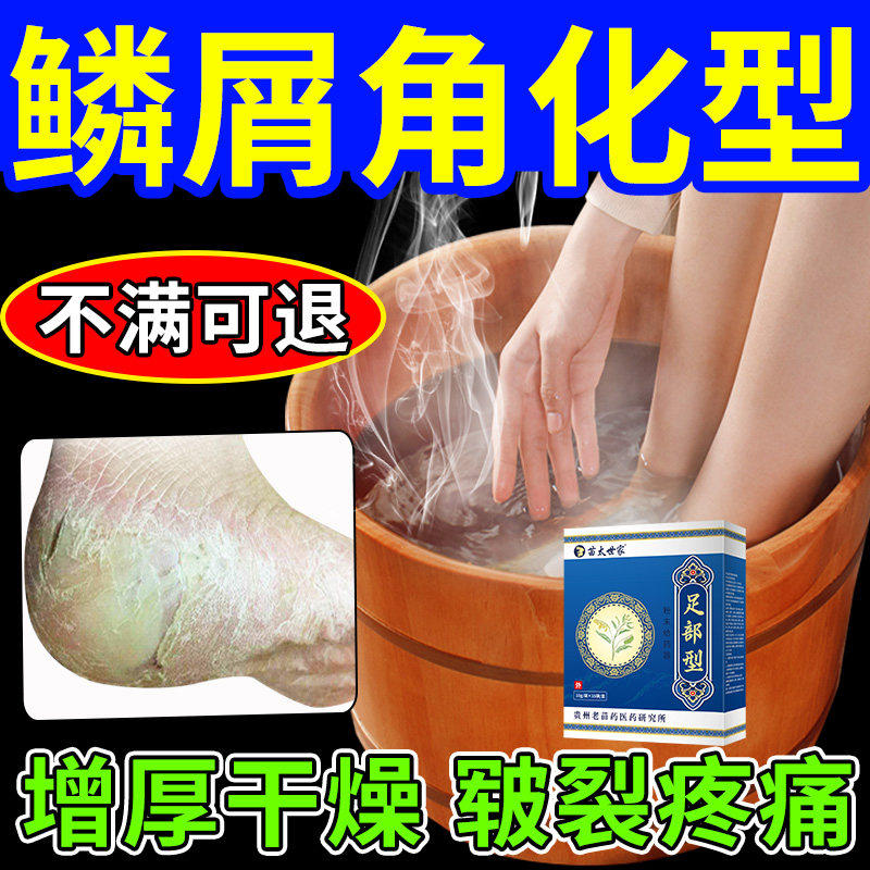 鳞屑角化型脚气专用瘙痒质
