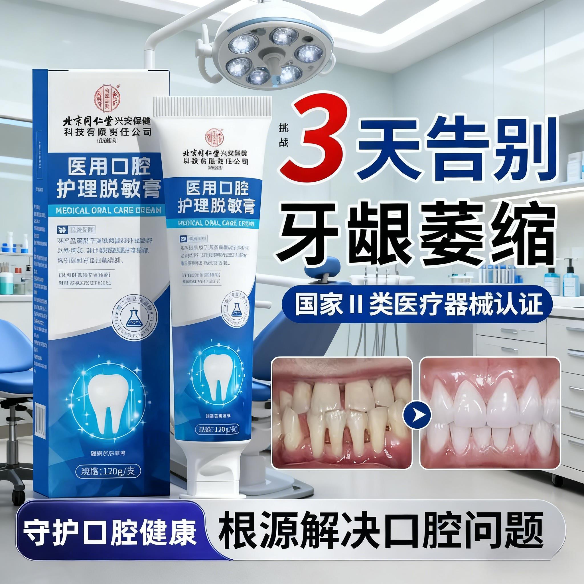 牙周炎口腔龈萎缩修复再生