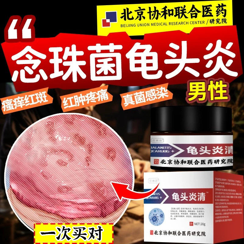 念珠菌性龟头炎感染特男霉